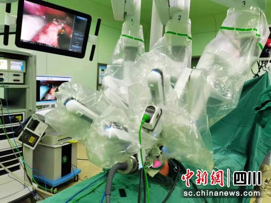 图为达芬奇手术机器人。成都市妇女儿童中心医院供图